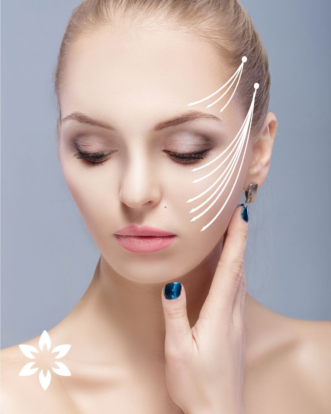 Tensado del óvalo facial
