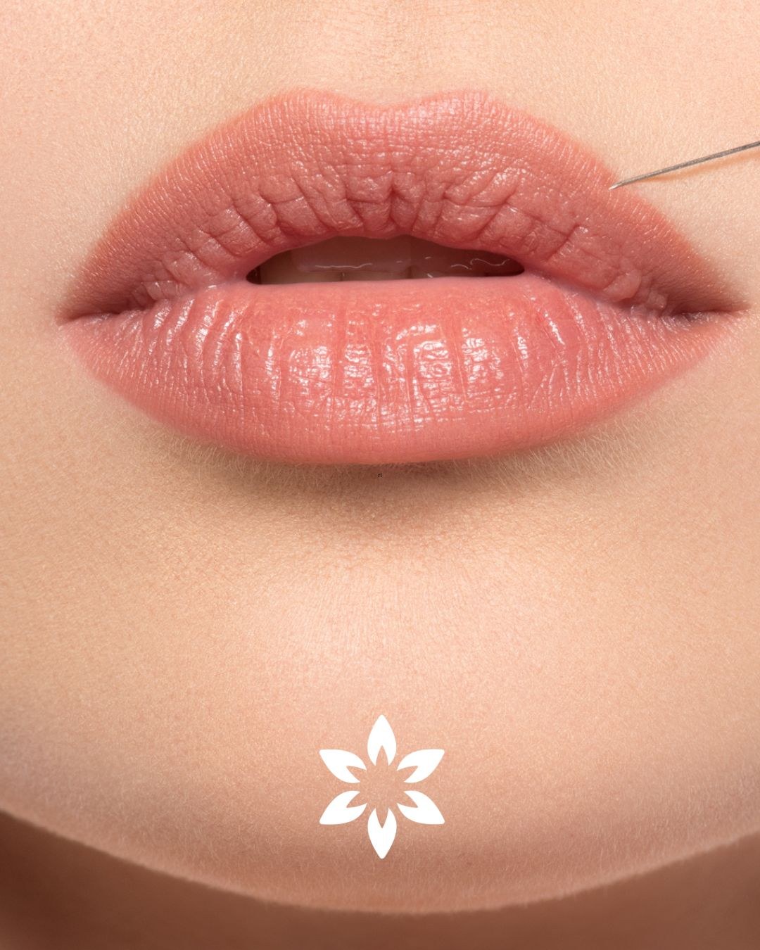 Relleno de labios