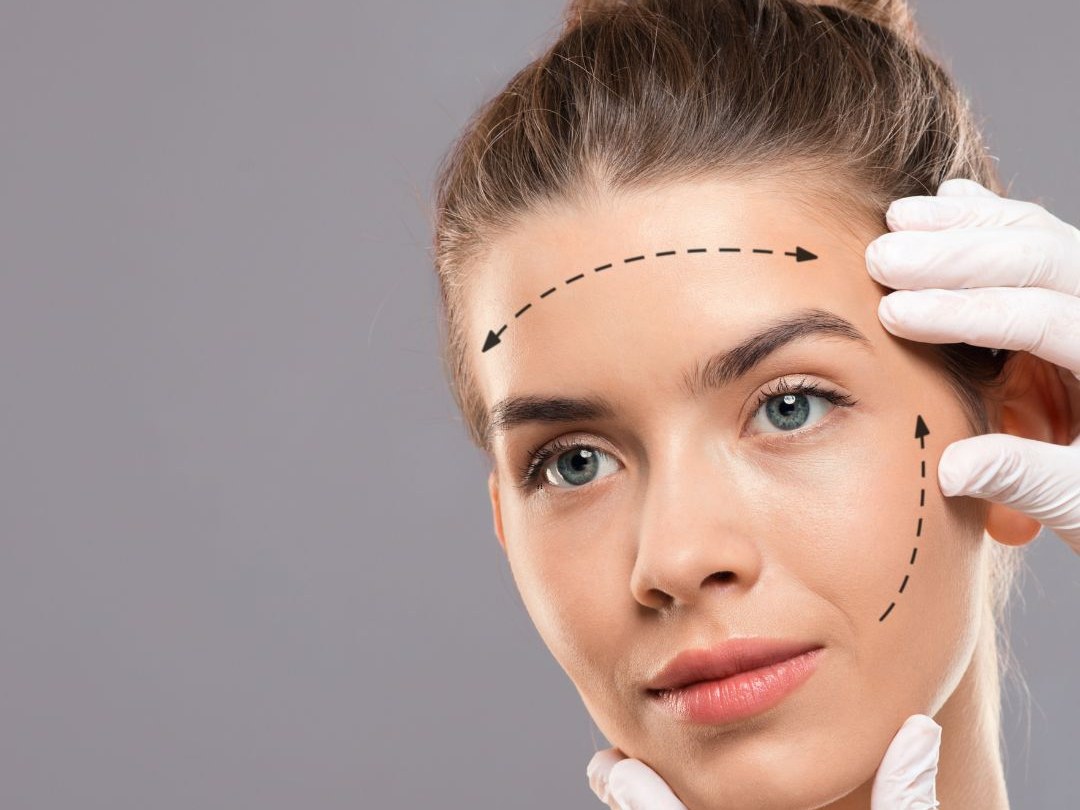 Ultrasonido microfocalizado facial